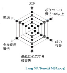 PRAダイヤグラムとは……