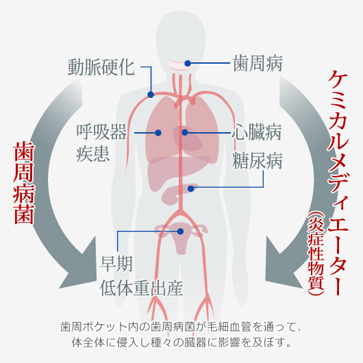 歯周病と全身疾患の関係